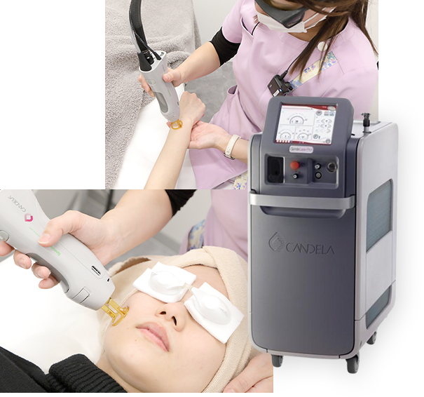 信頼のレーザー脱毛機