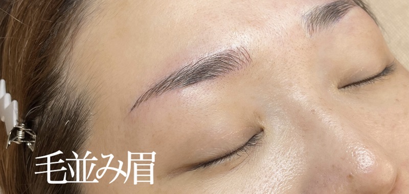 アートメイク施術例の紹介