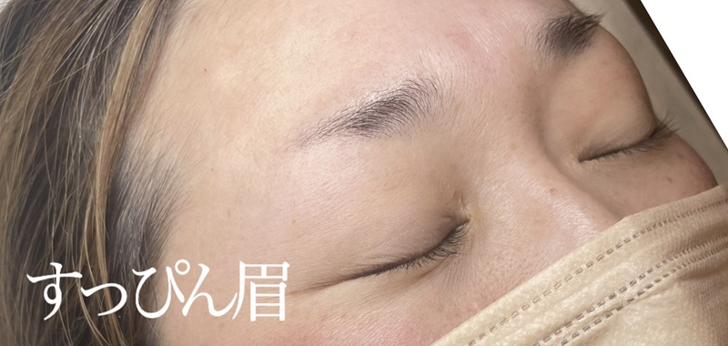 アートメイク施術例の紹介