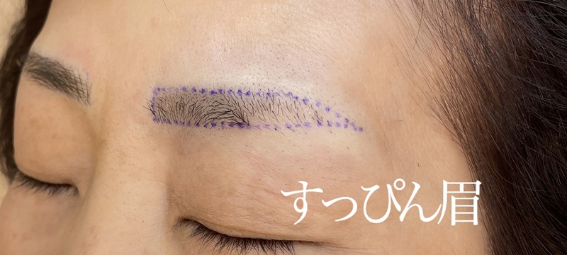 アートメイク施術例の紹介