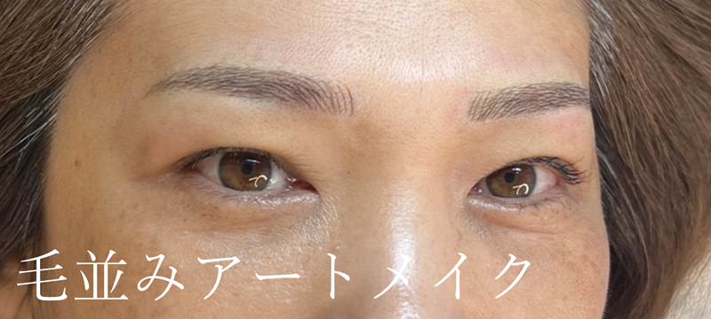 アートメイク施術例の紹介