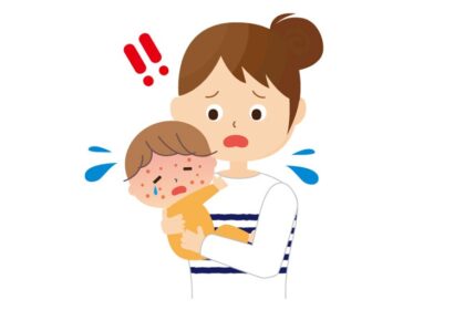 突発性発疹とは