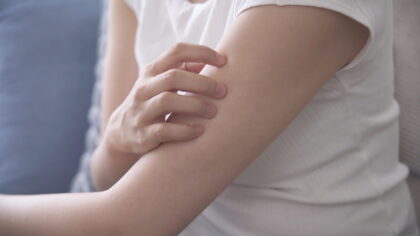 疥癬の症状チェック