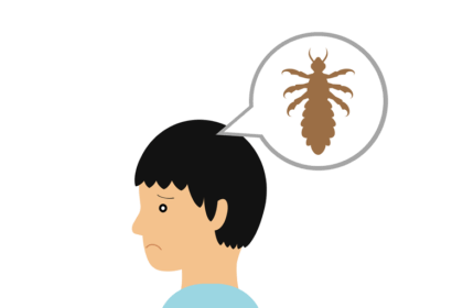 シラミ、頭ジラミの種類と原因～どこからうつる？～