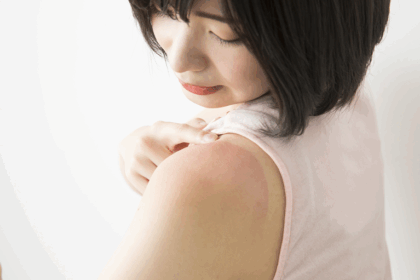 日焼けで赤くなる・黒くなる・ヒリヒリする方へ