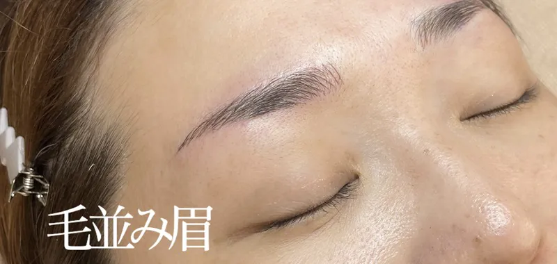 アートメイク施術例の紹介